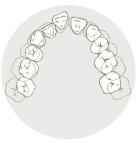 乳歯の歯並び
